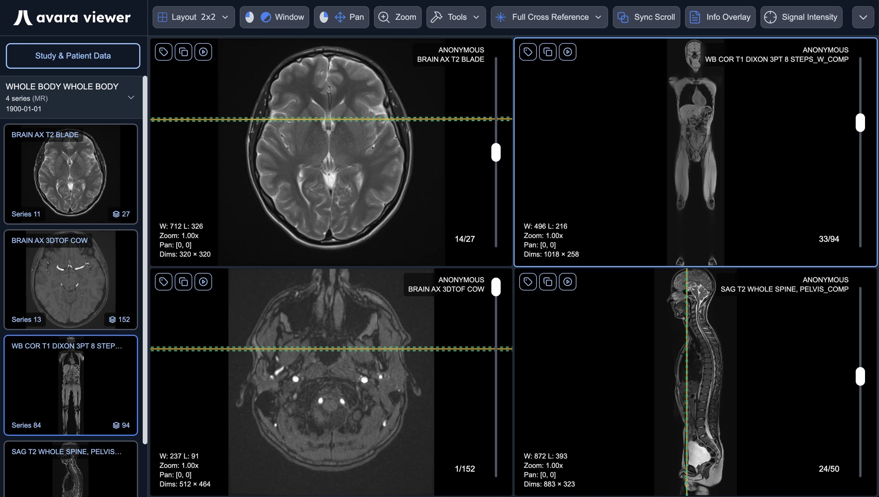 The Viewer Bottleneck: Why Radiologists Deserve Better (And How We Built It)