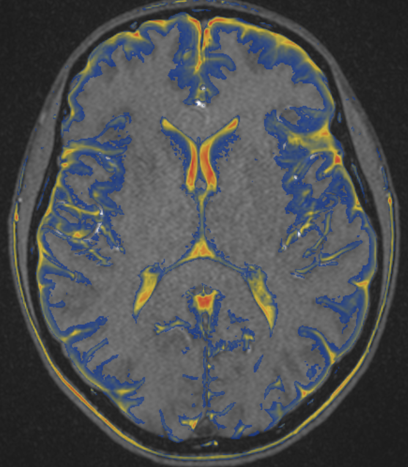 Fusion imaging
